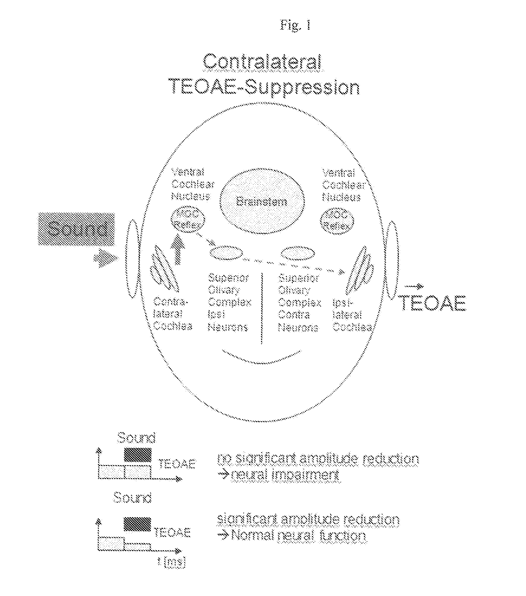 Method and Apparatus for Automated Detection of Suppression of TEOAE by Contralateral Acoustic Stimulation