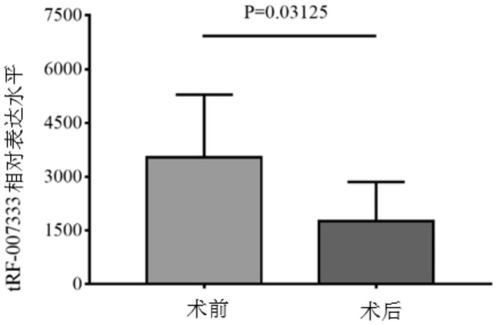 A kind of trf related to nsclc and its application