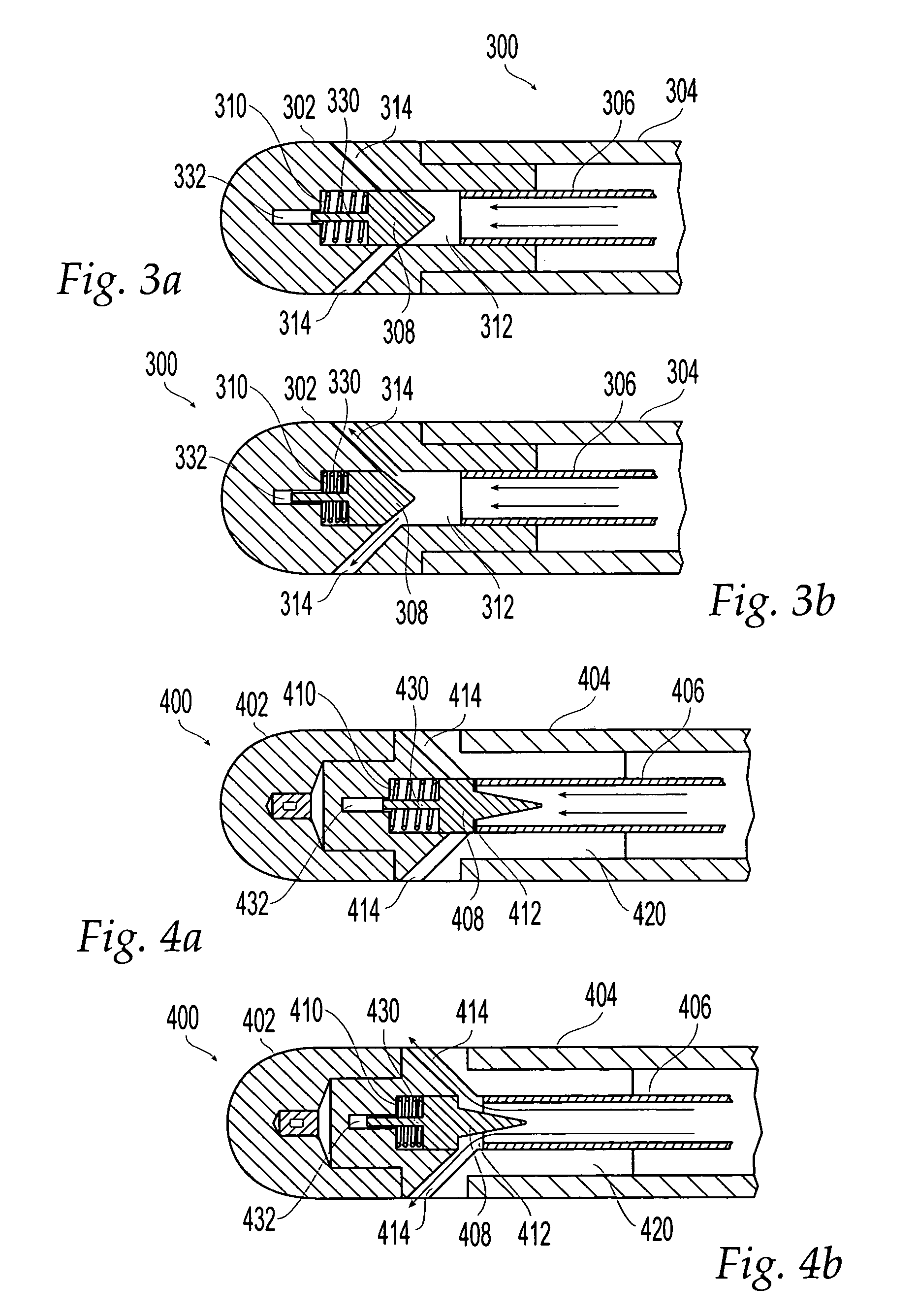 Irrigated ablation catheter system with pulsatile flow to prevent thrombus