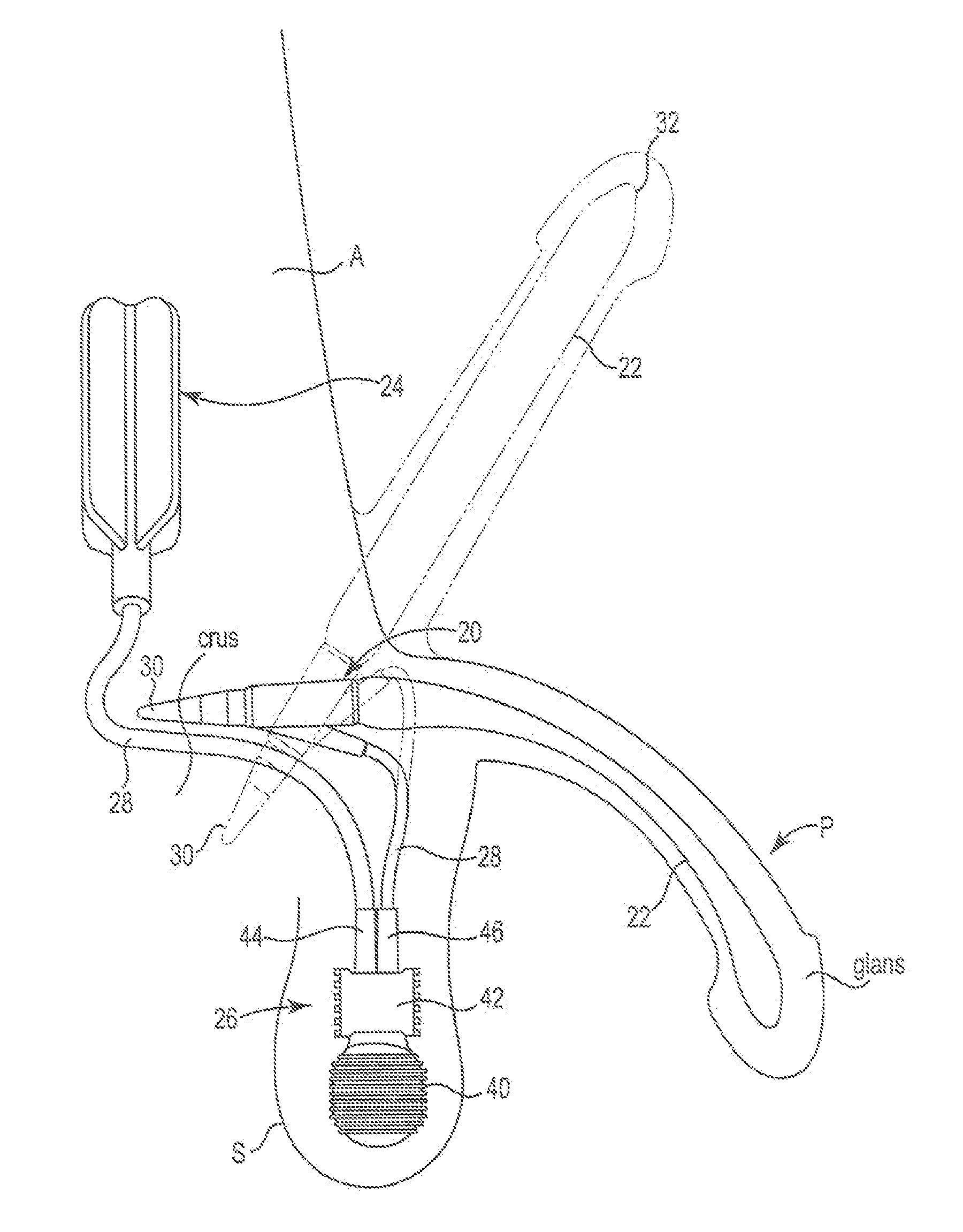 Penile prosthetic with Anti-autoinflation mechanism