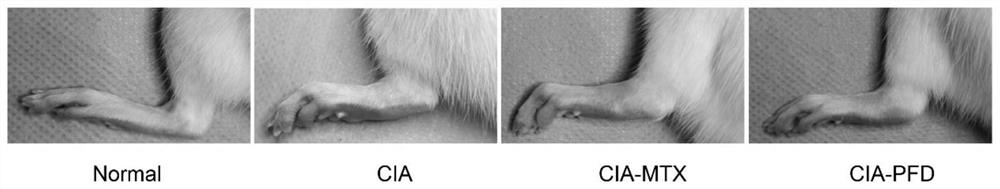 Application of pirfenidone to preparation of medicine for preventing and treating rheumatoid arthritis