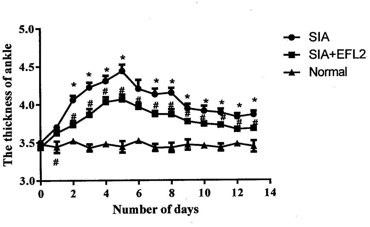 Application of euphorbia factor L2 to preparation of medicine for treating rheumatoid arthritis