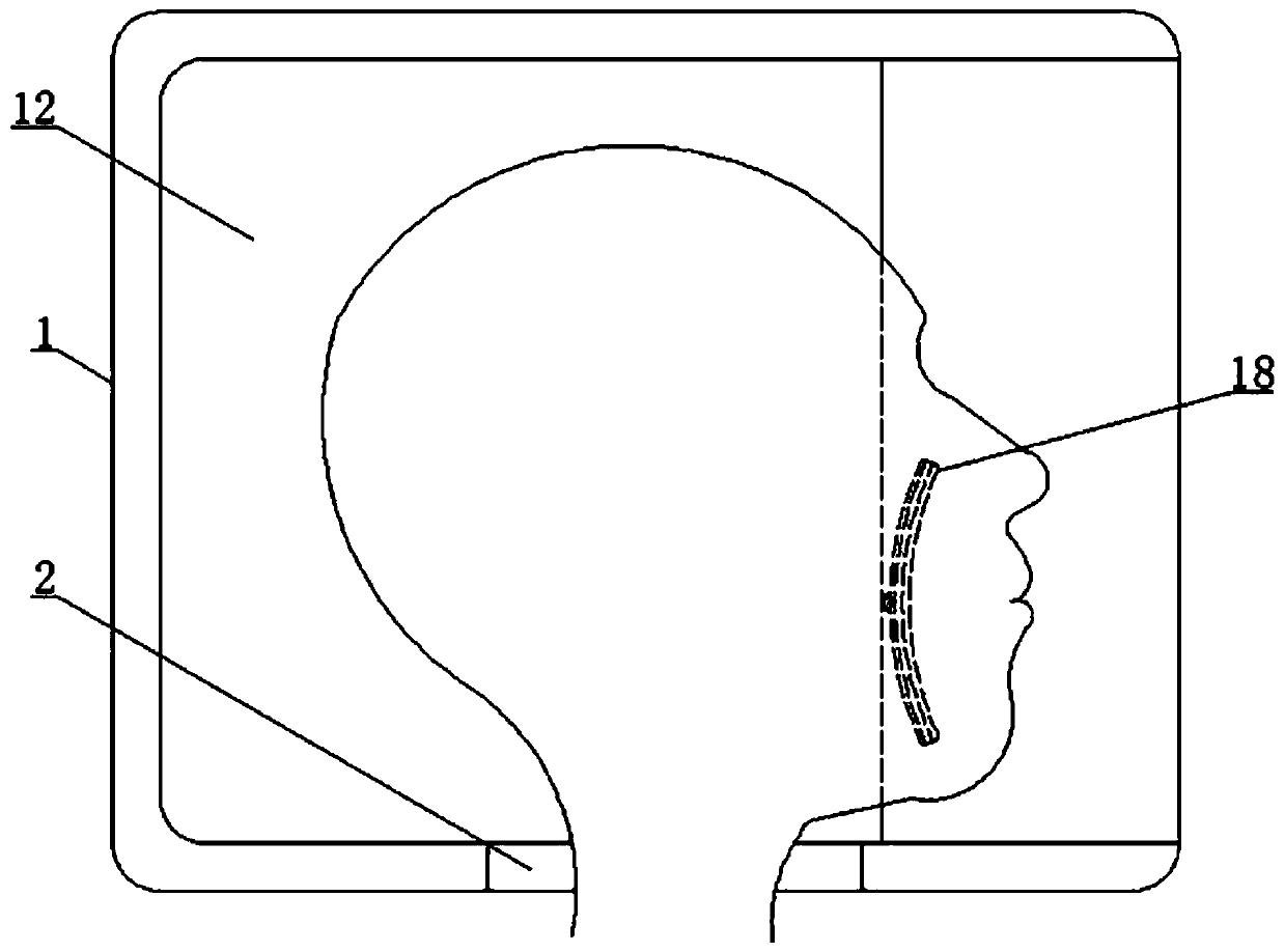 Gastroscopy medical protection pad capable of preventing status of gastric juice contamination