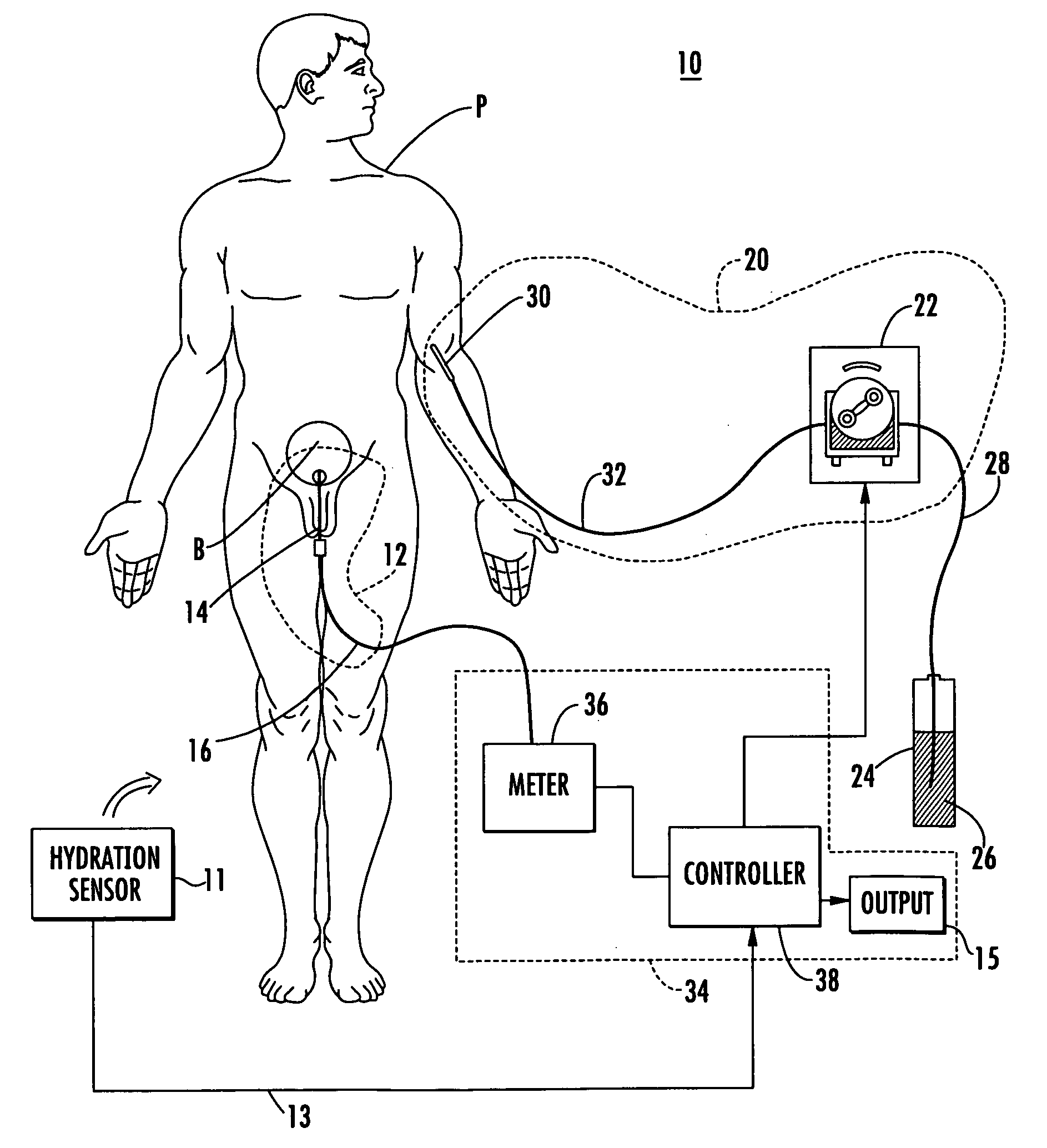 Patient hydration system with hydration state detection