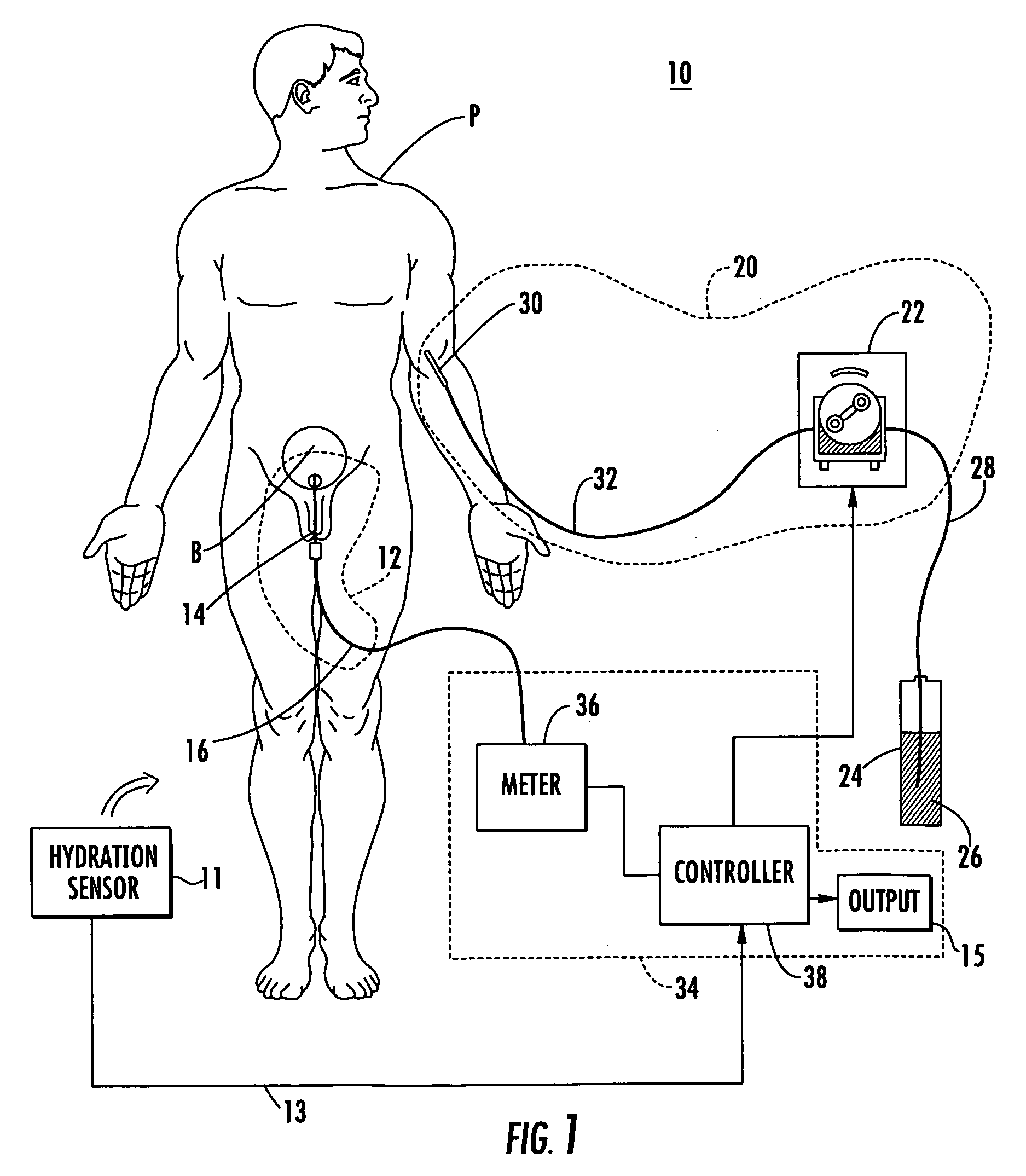 Patient hydration system with hydration state detection