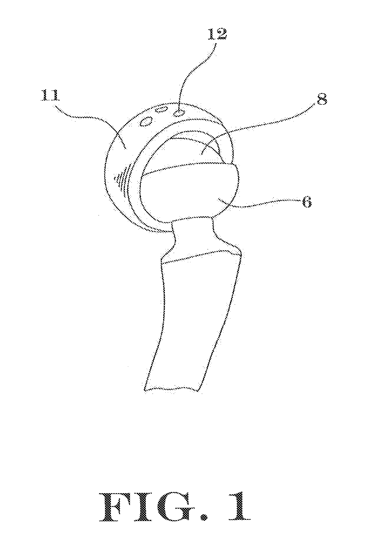 Interlocking Reverse Hip and Revision Prosthesis