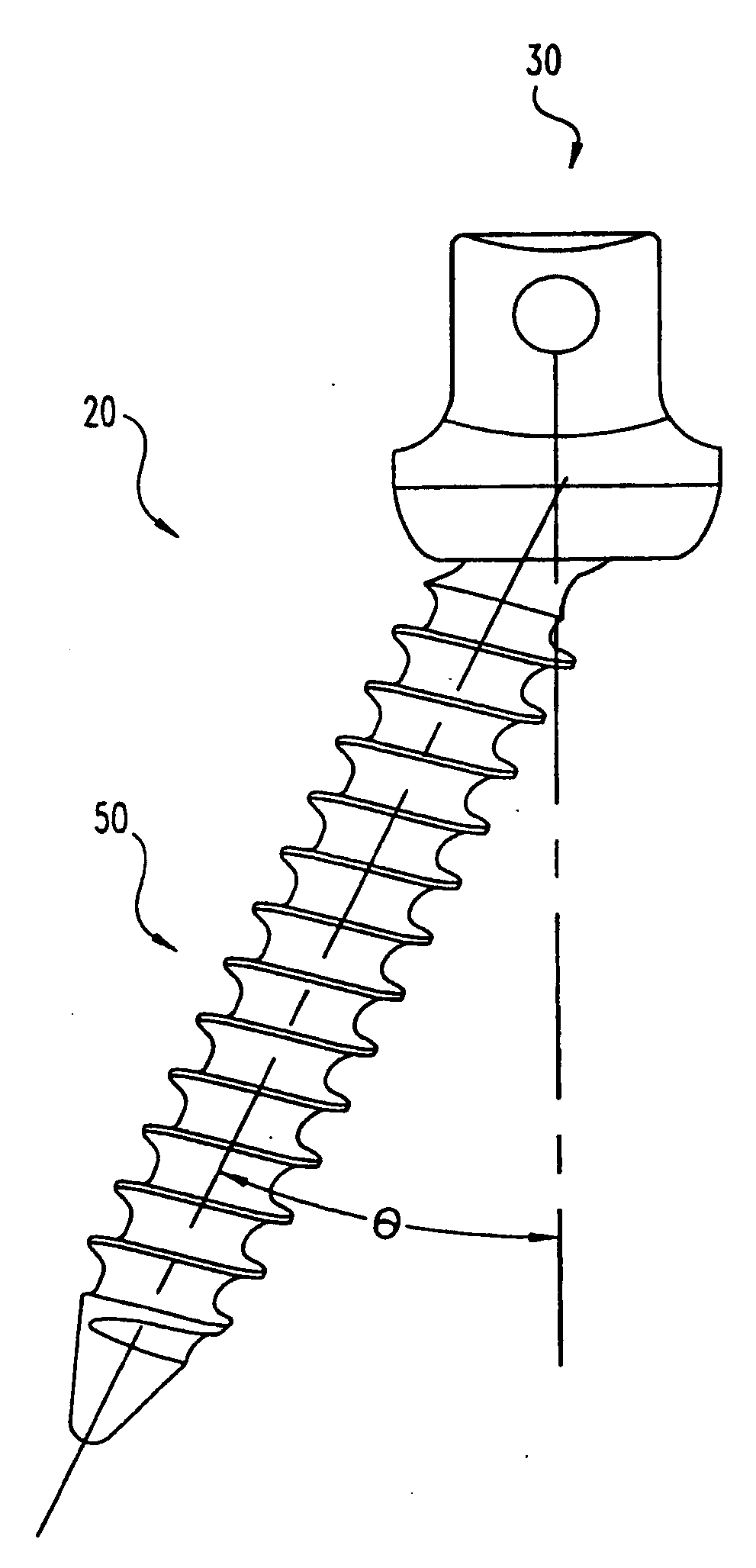 Multi-Axial Bone Screw Assembly