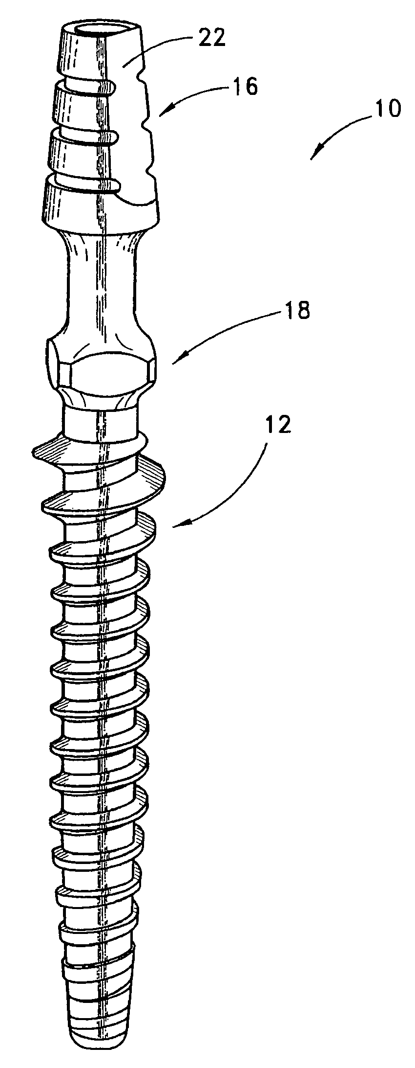 Immediate provisional implant