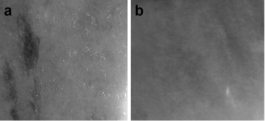 Dry -particle decorative ceramic tile and preparation method thereof