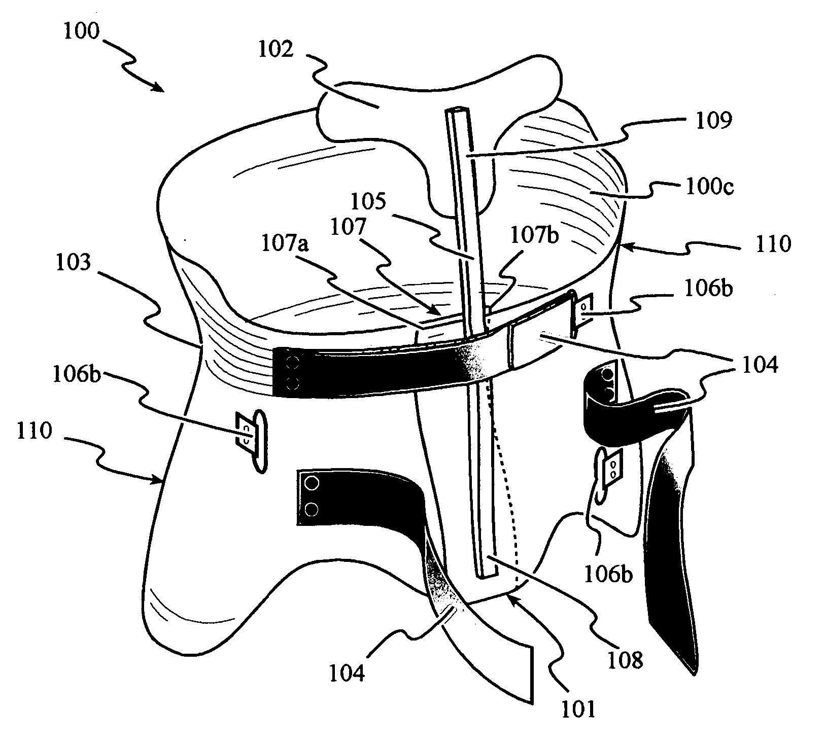 Total contact thoraco-lumbosacral spinal orthosis