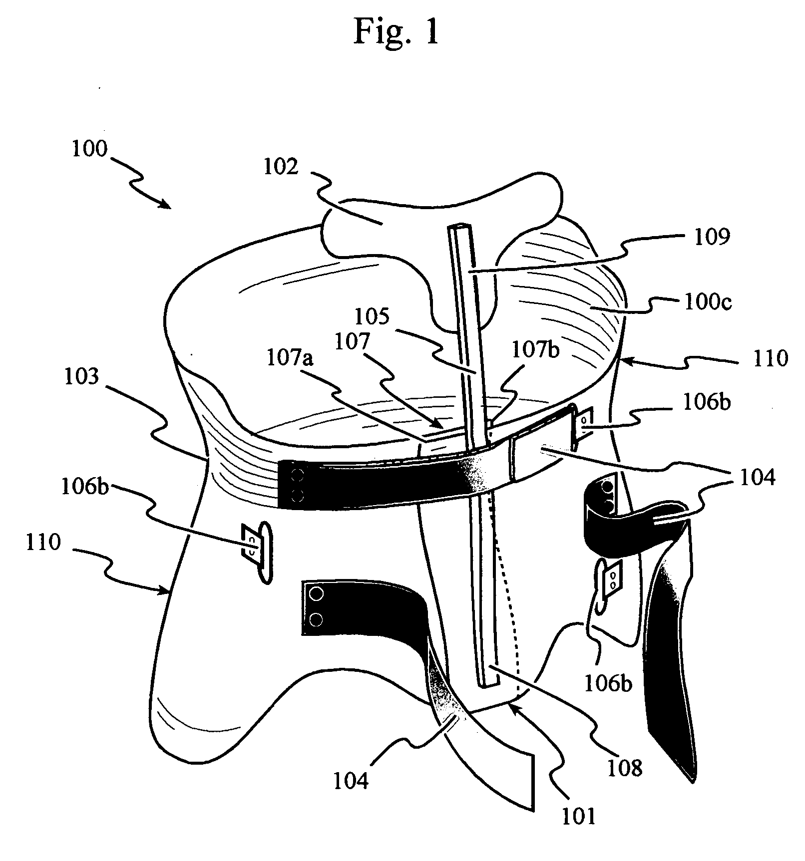 Total contact thoraco-lumbosacral spinal orthosis