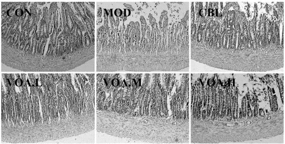 Fructus Amomi volatile oil soft capsule for alleviating chemotherapy induced intestinal mucosa damage