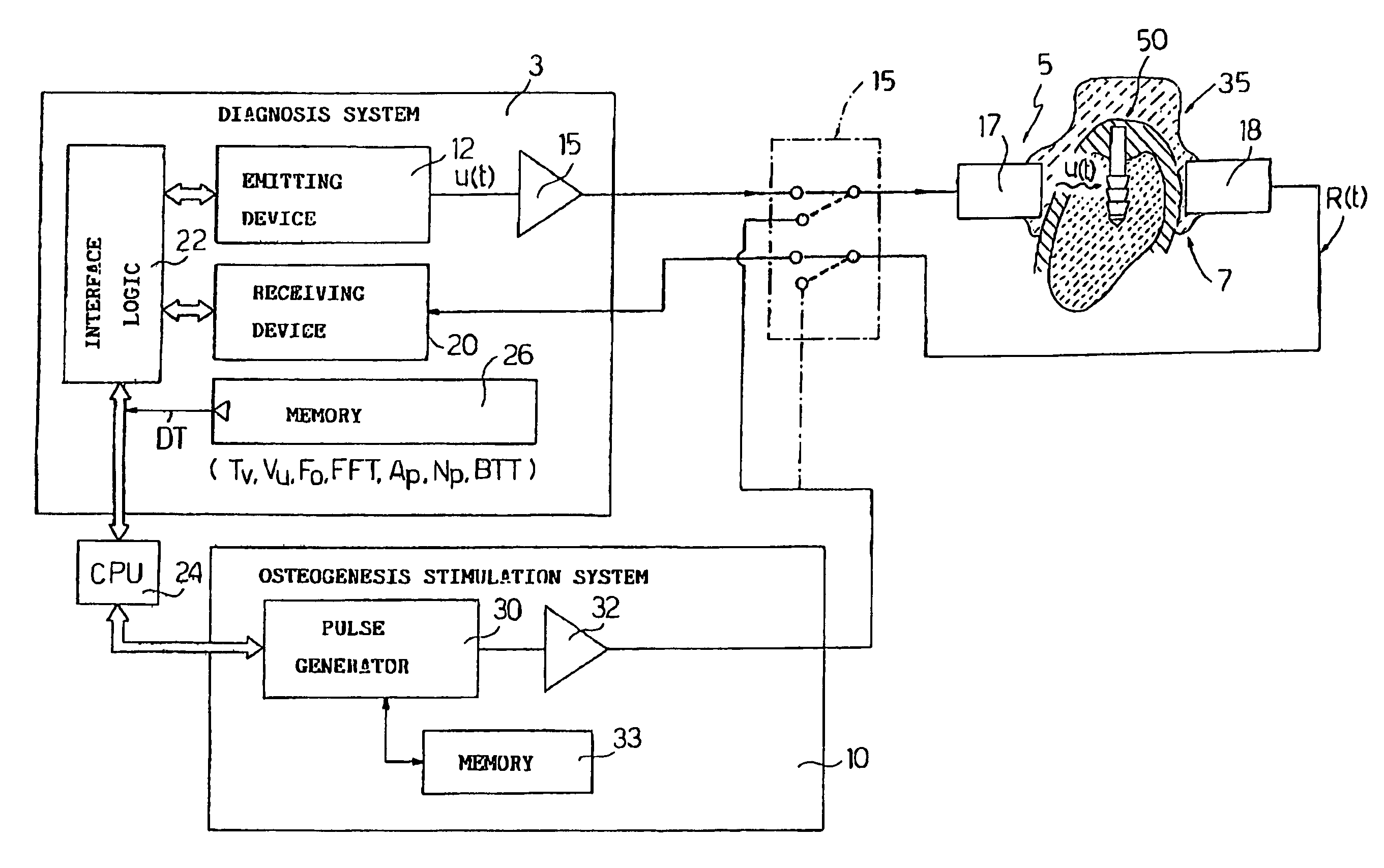 Electronic system for determining the density and structure of bone tissue and stimulating osteogenesis in dentistry