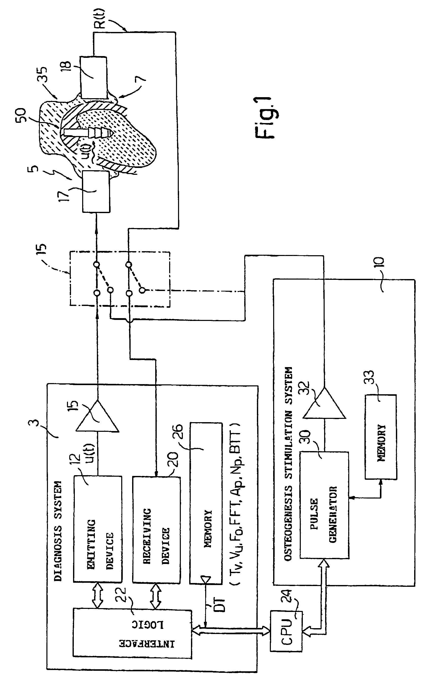 Electronic system for determining the density and structure of bone tissue and stimulating osteogenesis in dentistry