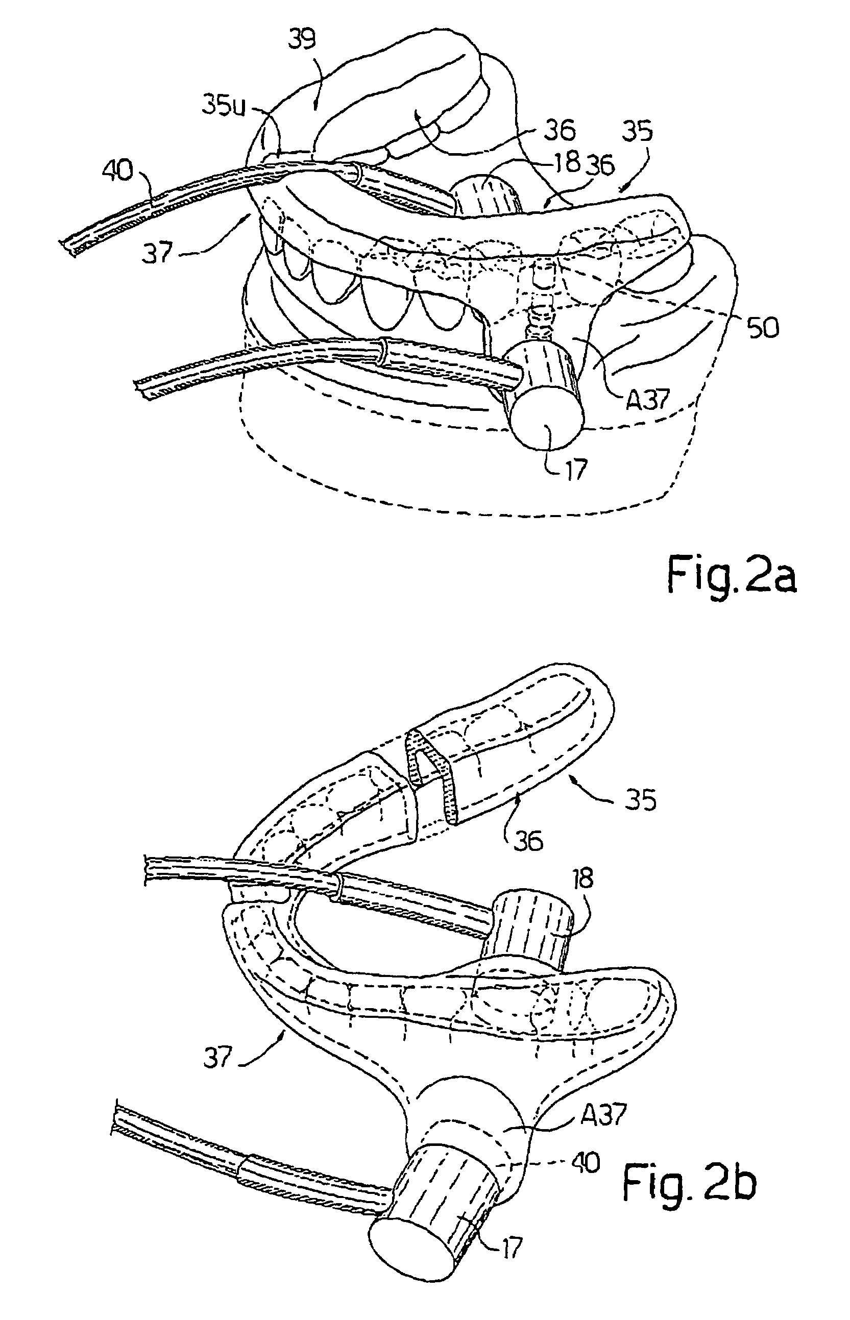 Electronic system for determining the density and structure of bone tissue and stimulating osteogenesis in dentistry