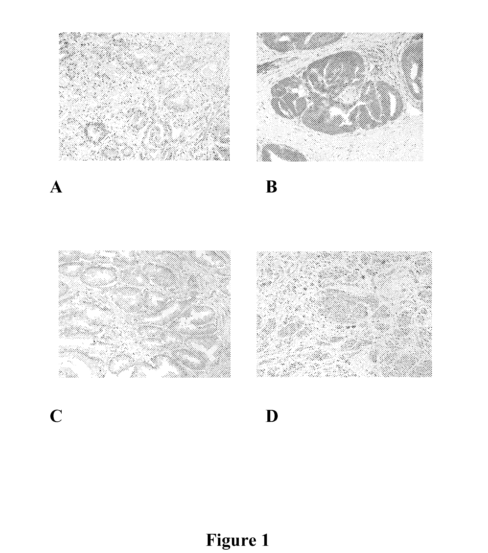 DETECTION OF PHOSPHORYLATED eIF2-alpha AS A DIAGNOSTIC TEST FOR EFFICACY AND SENSITIVITY OF TRANSLATION INITIATION INHIBITORS IN THE TREATMENT OF CANCER AND OTHER PROLIFERATIVE DISEASES