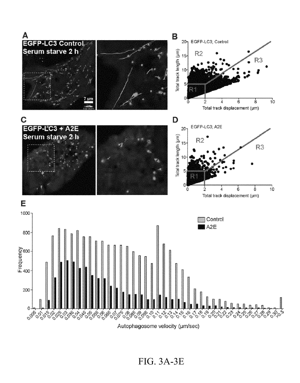 Use of inhibitors of acid sphingomyelinase to treat acquired and inherited retinal degenerations