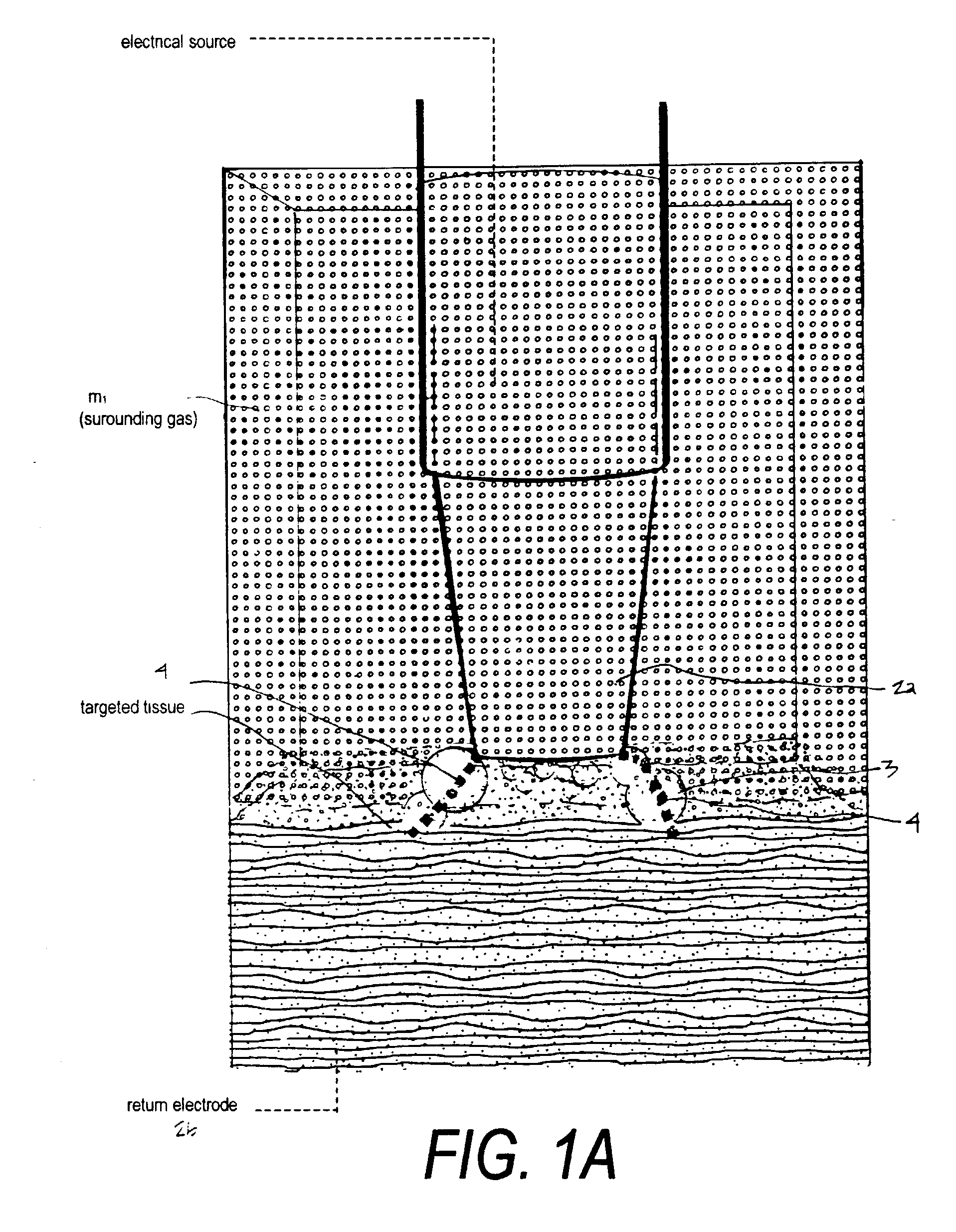 Electrical discharge devices and techniques for medical procedures