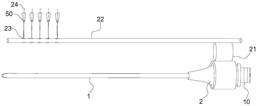 RV-type system positioning guide and feather line 3D long-term locking lifting components