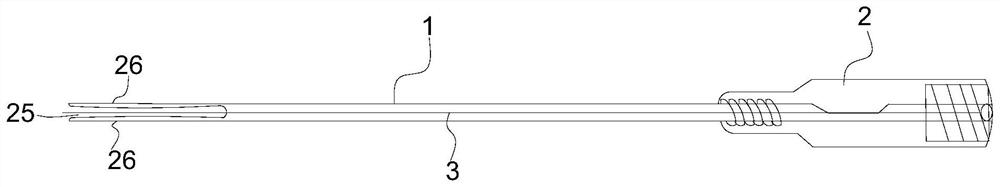 RV-type system positioning guide and feather line 3D long-term locking lifting components