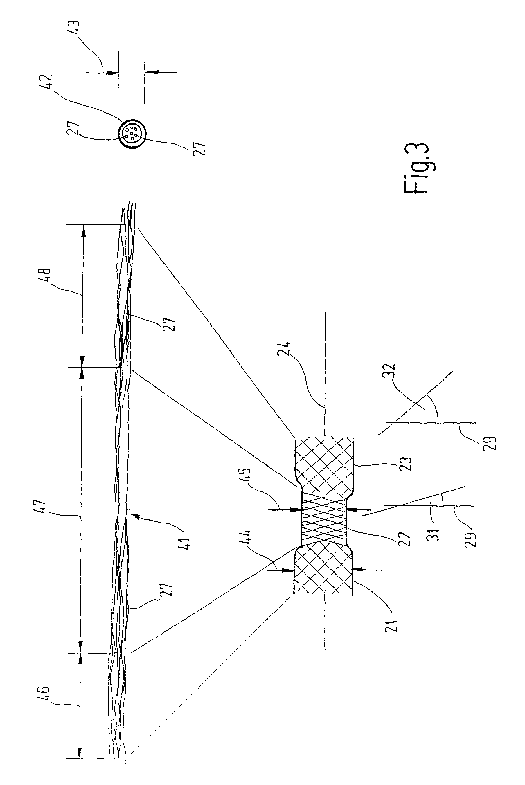 Braided stent to be implanted in a blood vessel