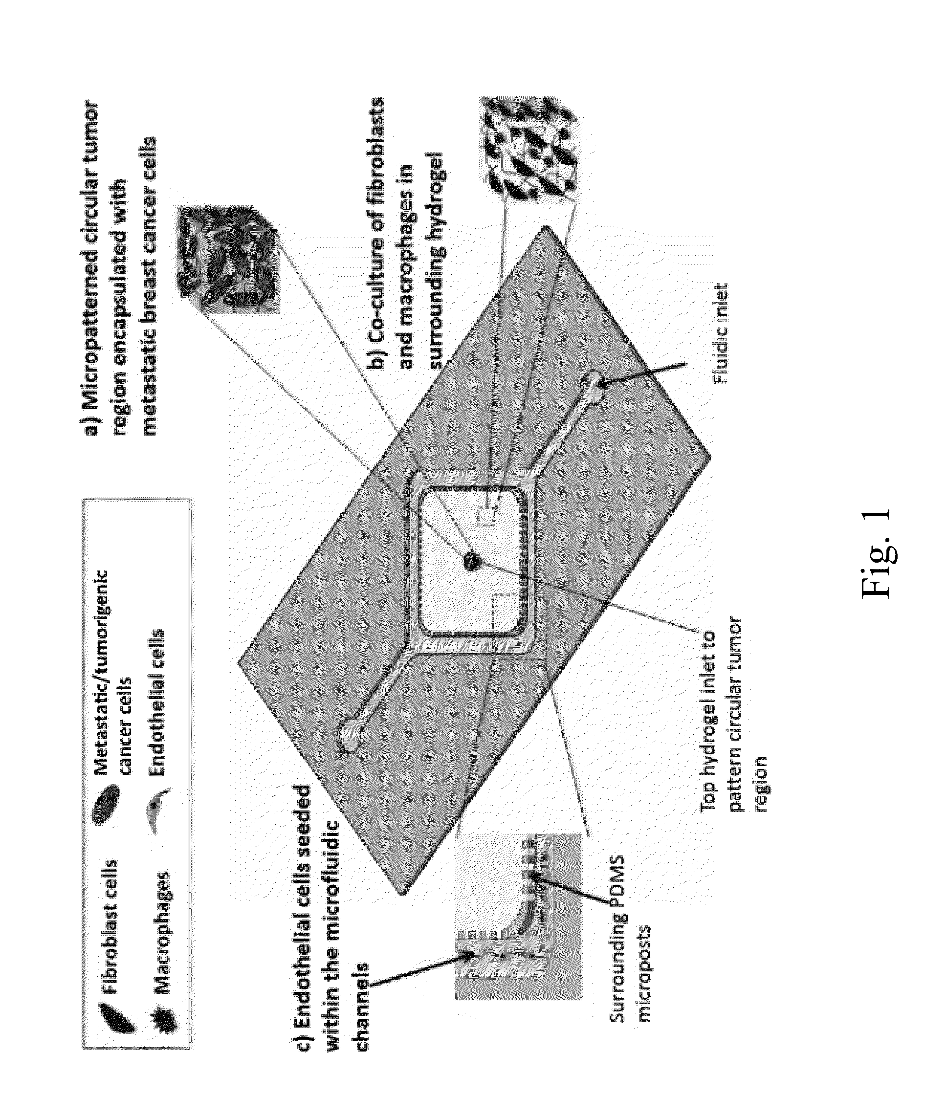 Engineering Of A Novel Breast Tumor Microenvironment On A Microfluidic Chip