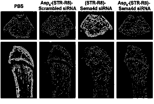 Bone-targeted RNA interference compound and synthetic method thereof