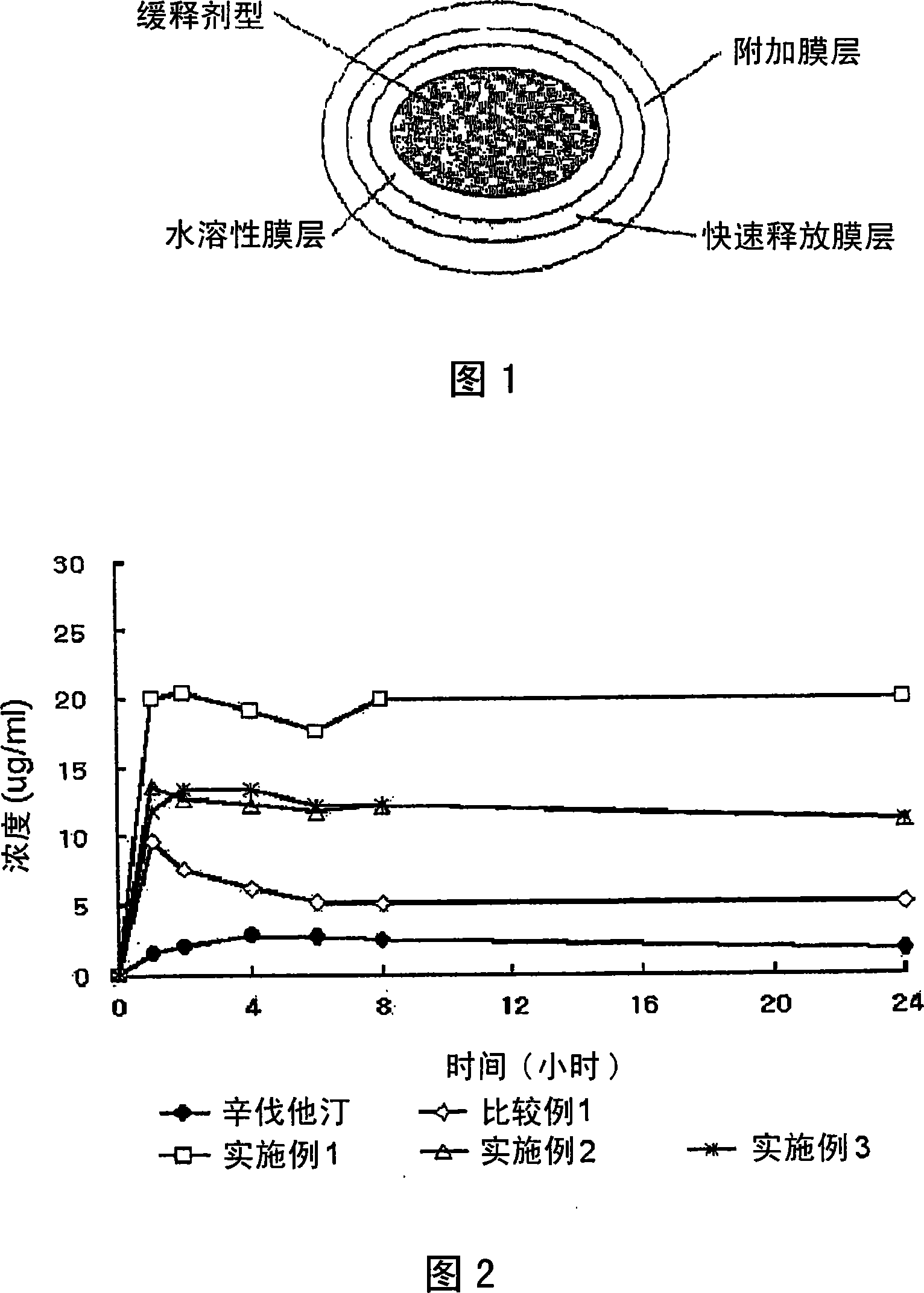 Complex formulation of 3-hydroxy-3-methyl glutaryl coa reductase inhibitor and antihypertensive agent, and process for preparing same