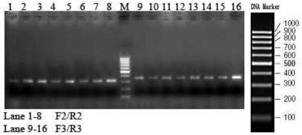 Construction method of mouse model simulating human acute pancreatitis