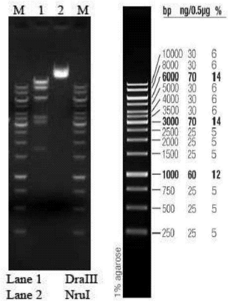 Construction method of mouse model simulating human acute pancreatitis