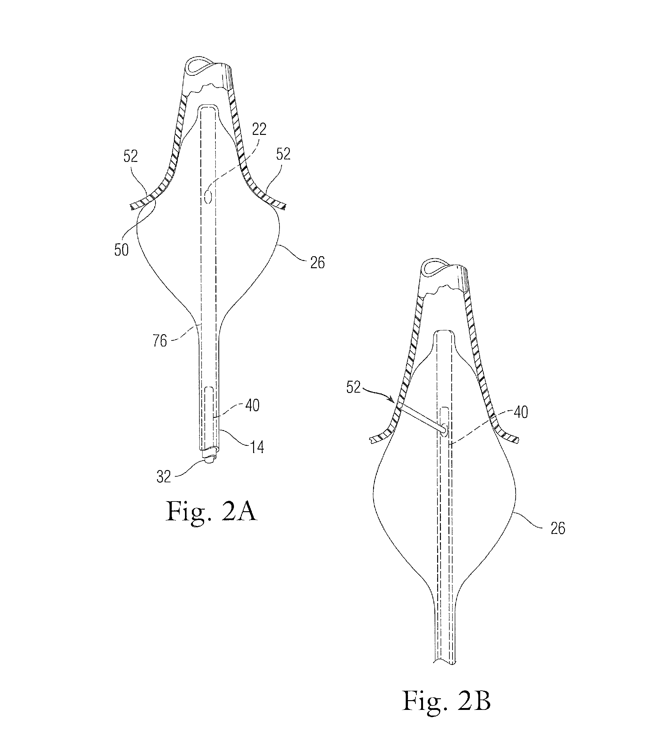 Cardiac ablation catheters for forming overlapping lesions