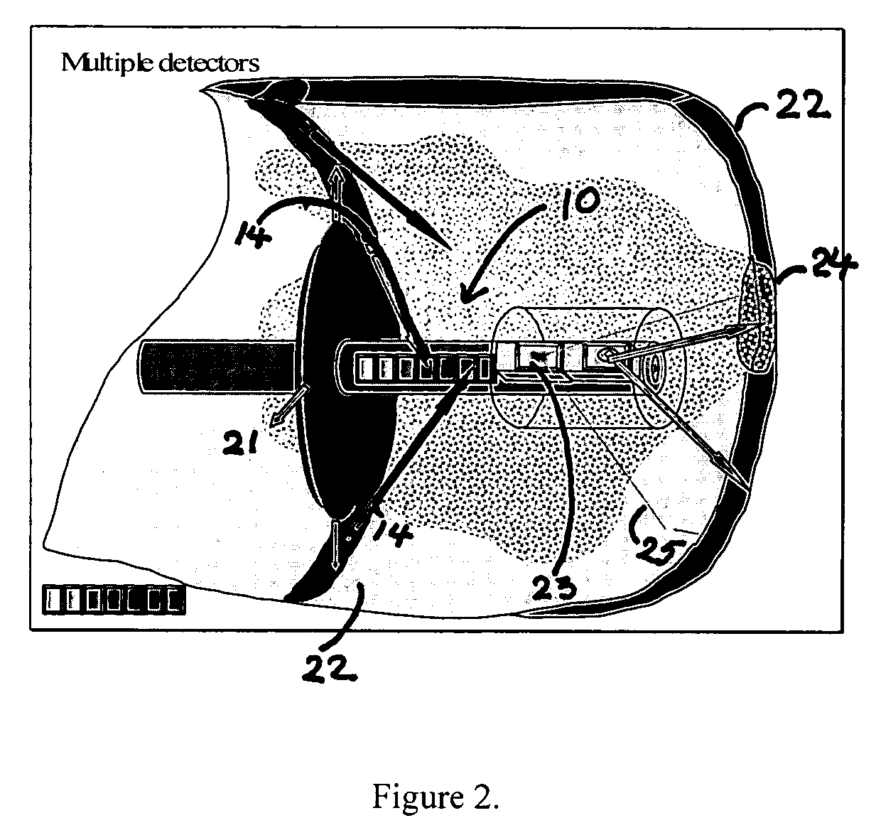 Intravascular imaging device and uses thereof