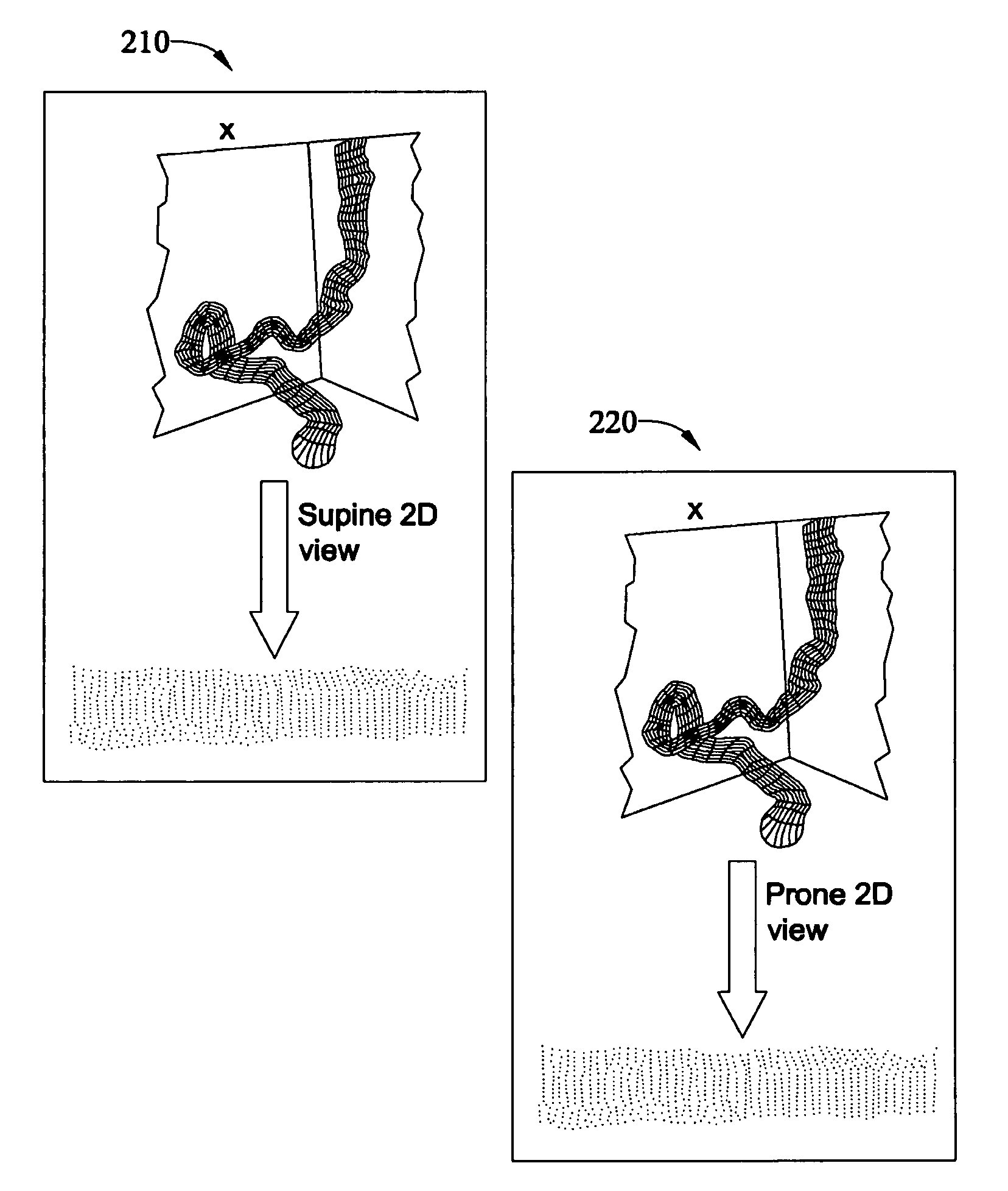 Method and apparatus for synchronizing corresponding landmarks among a plurality of images