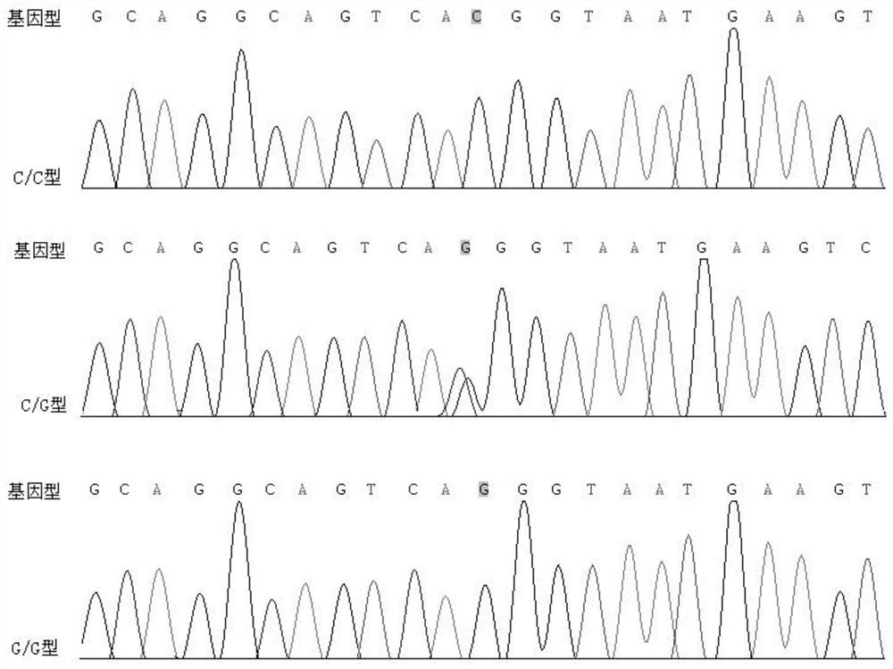 A biomarker for early diagnosis of ankylosing spondylitis and its application in kit