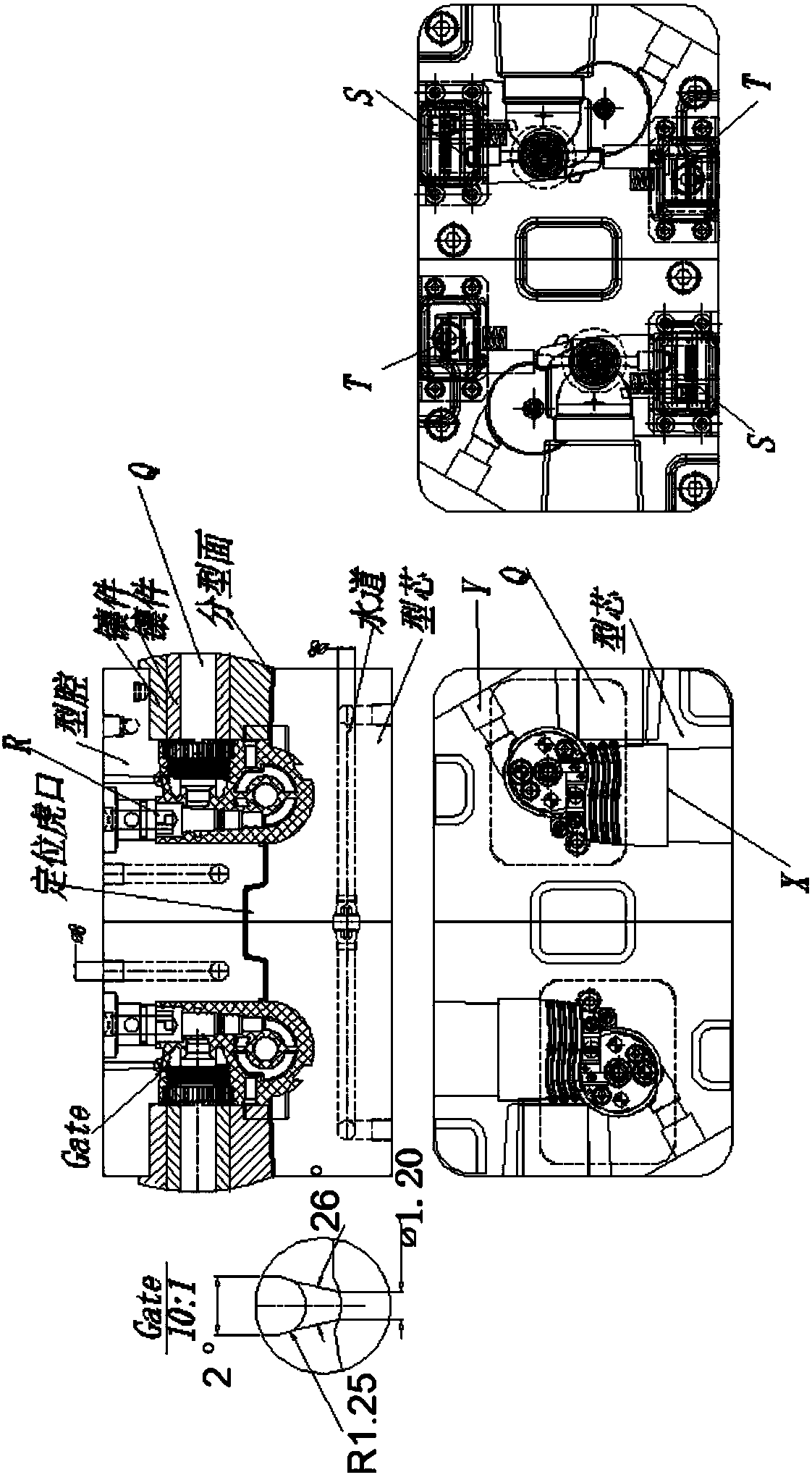 Medical infusion pump body and manufacturing method thereof