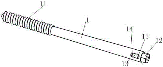 Integrated fixing device for olecranal fracture