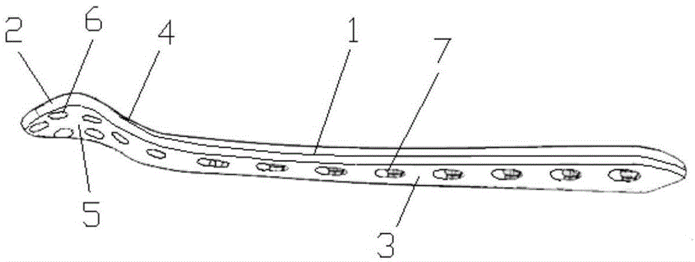 Bone plate implanted from front inner side of distal femur