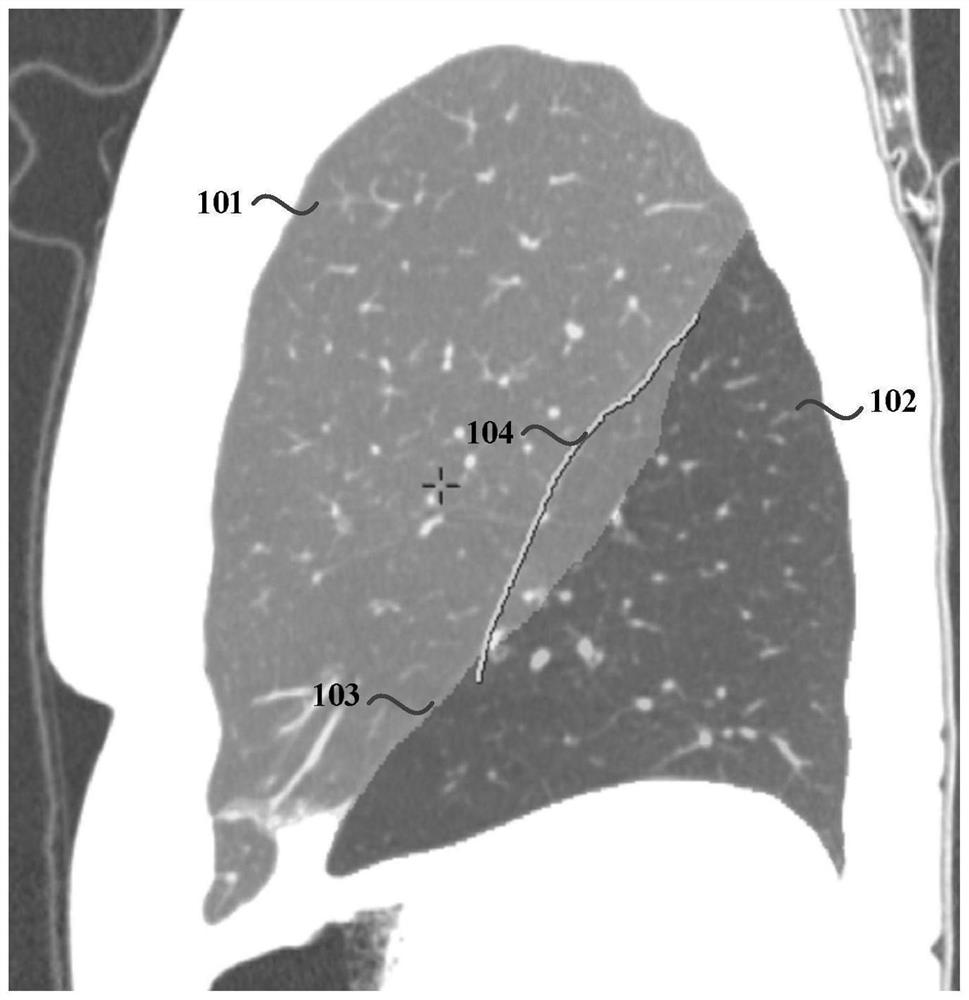 A lung lobe segmentation method, device, computer equipment and storage medium