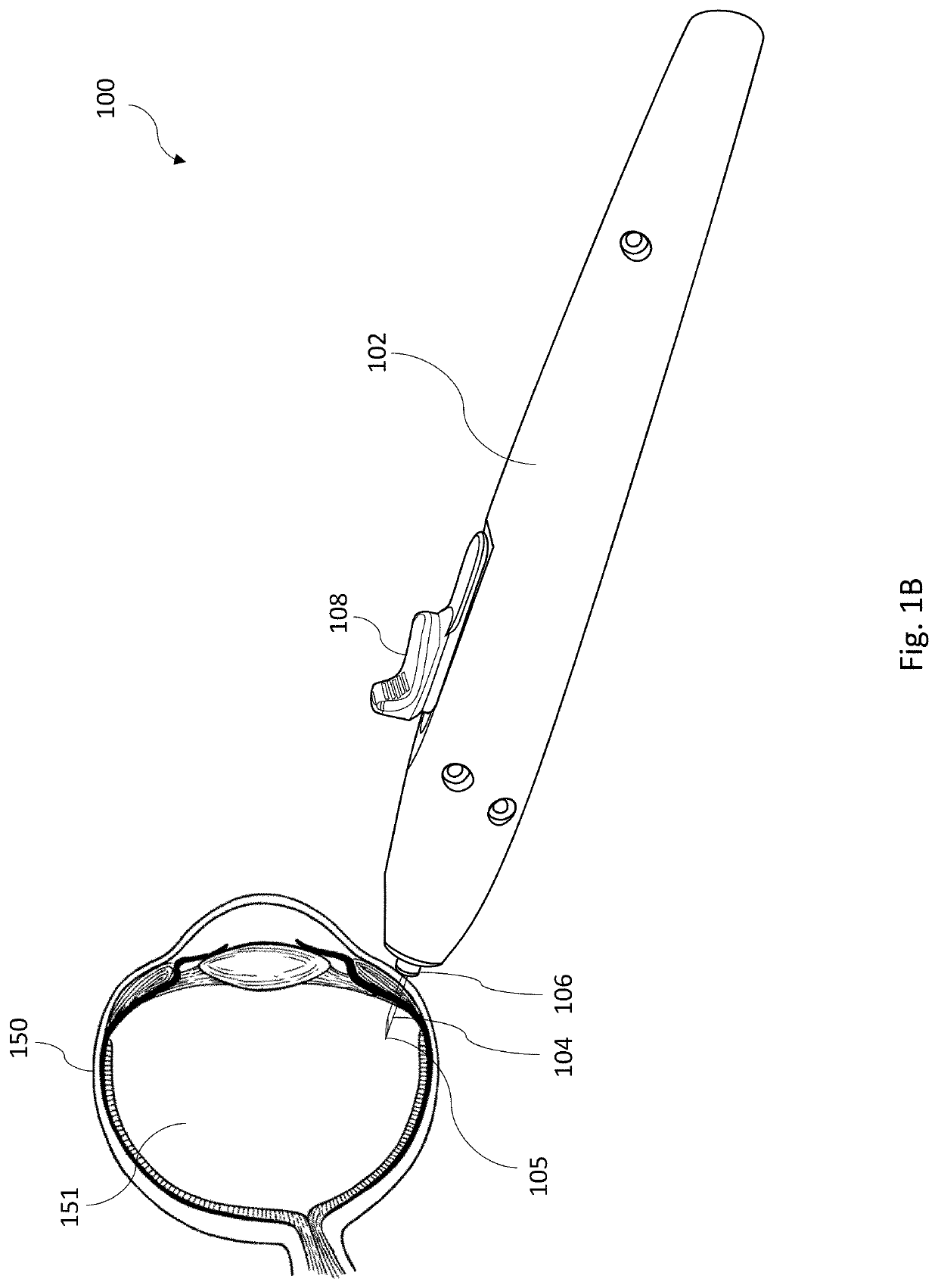 Intraocular injector