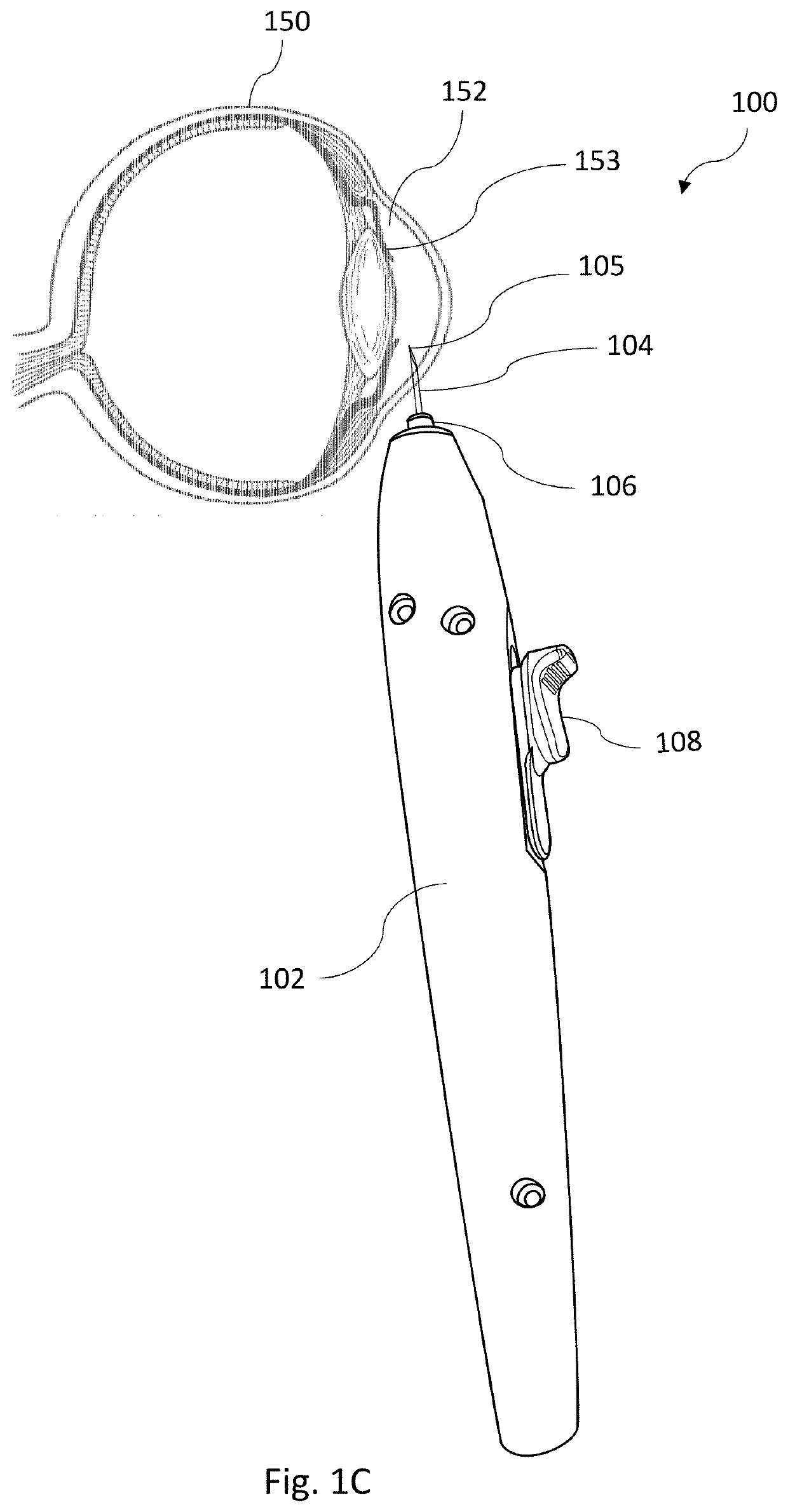 Intraocular injector