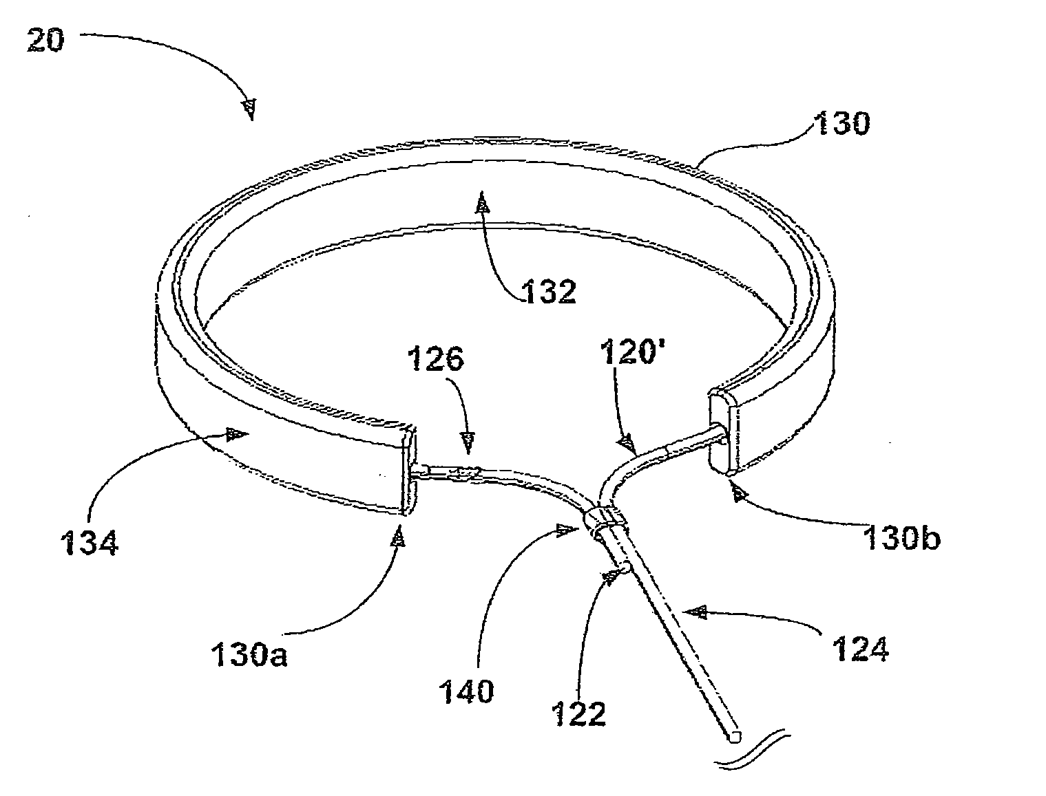 Apparatus and methods for minimally invasive obesity treatment