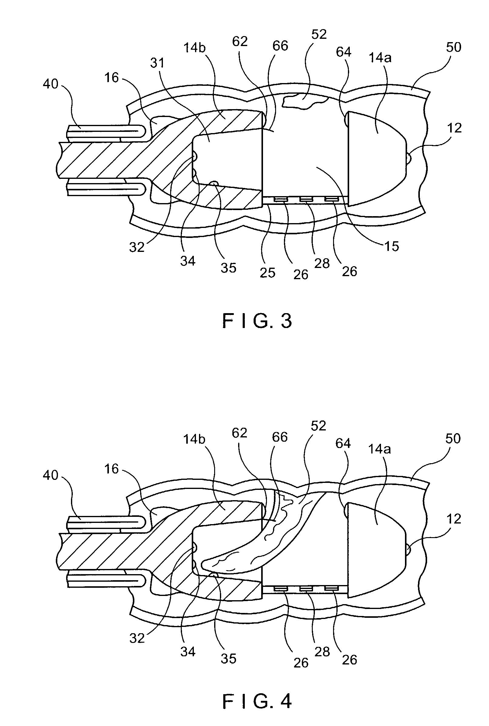 Full thickness resection device