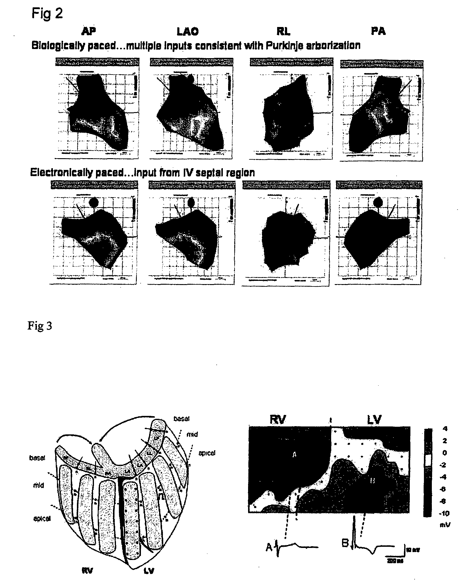 Methods and compositions to treat arrhythmias