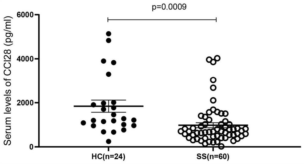 Application of chemotactic factor CCL28 as marker in preparation of sicca syndrome diagnostic reagent