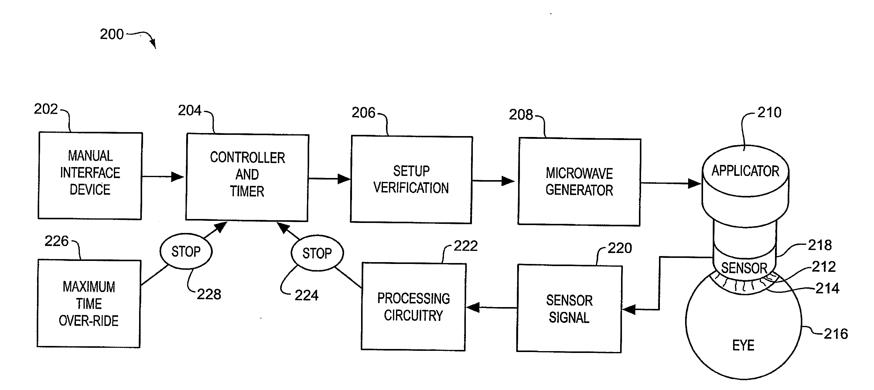 Thermokeratoplasty systems