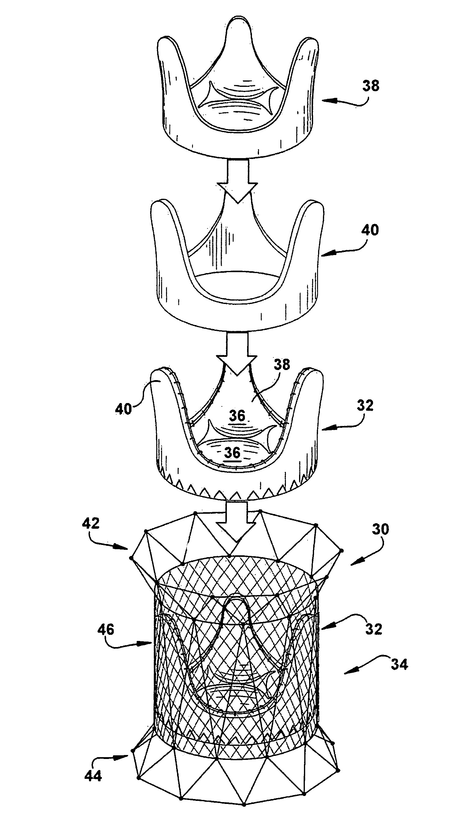 Method for implanting a cardiovascular valve