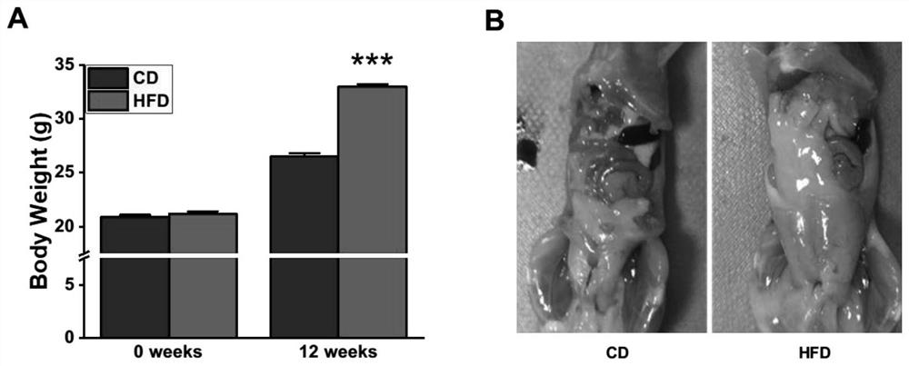 Construction method and application of acute pancreatitis animal model