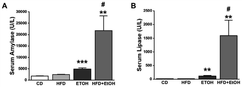 Construction method and application of acute pancreatitis animal model