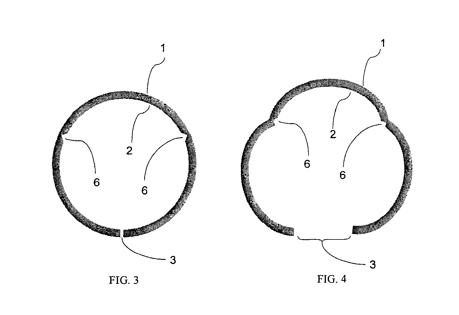 Encasement devices and methods for planting mangroves