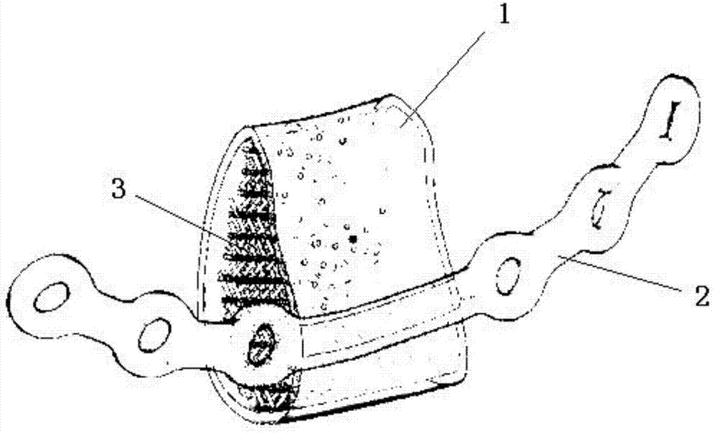 Manufacturing method of individualized prosthesis with porous structure